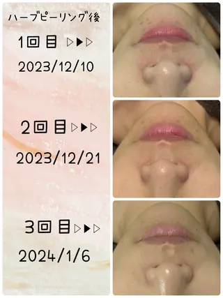 リンパケアサロン 🧡Relairのエステ・リラクイメージ