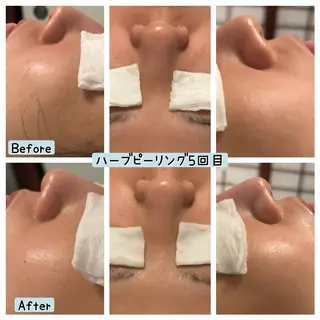 ぱんだ王国エステ所属・ぱんだ王国 エステのエステ・リラクイメージ