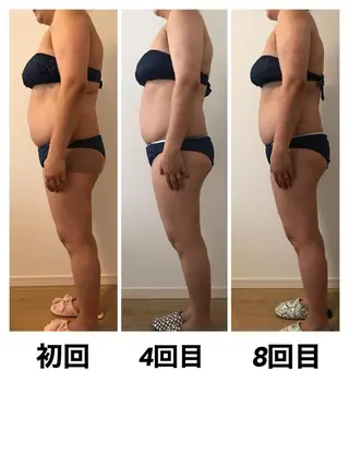 エステティックサロンPartagé【パルタージュ】所属・小尻・太もも痩せる パルタージュのエステ・リラクイメージ