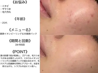 🔥3か月で肌革命 🔥ニキビ専門店のエステ・リラクイメージ