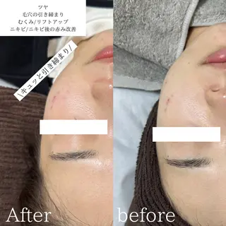 lafleur Yurinaのエステ・リラクイメージ