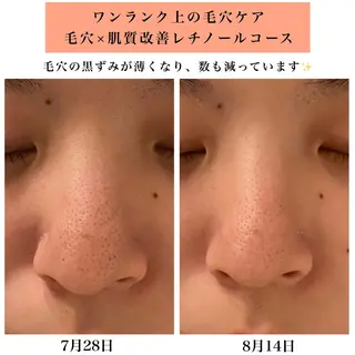 Bellesthe (ベルエステ)のエステ・リラクイメージ