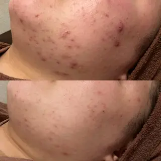 触れたくなる モテ肌へ...❤︎のエステ・リラクイメージ