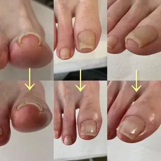 ネイル Takasaki Keikoのネイルデザイン