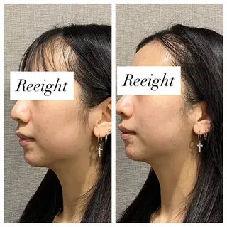 肌質改善専門 ハーブ /毛穴洗浄 リエイトのエステ・リラクイメージ