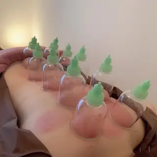 新宿hari-me所属・美容鍼hari-me 新宿のエステ・リラクイメージ