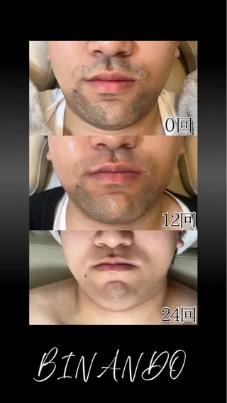 メンズ BINANDO 鎌田のエステ・リラクイメージ