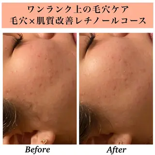 Bellesthe (ベルエステ)のエステ・リラクイメージ