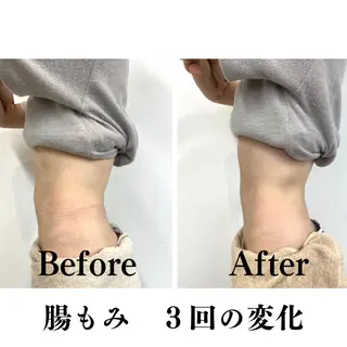 美容姿勢整体Cinq所属・𝐂𝐢𝐧𝐪🎗 腸もみ｜美容整体のエステ・リラクイメージ
