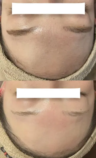 マツエク・マツパ キッズ メンズ アイブロウ Epina 千葉店 【エピナ】のエステ・リラクイメージ