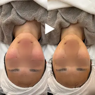 肌質改善サロン🌕 ⠀【ルーナピエナ】のエステ・リラクイメージ