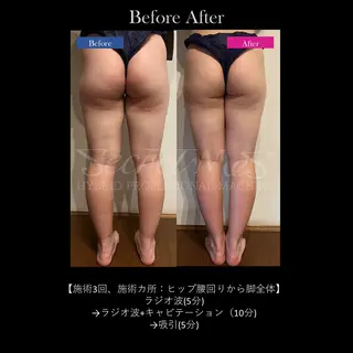 プライベートサロン W.beautyのエステ・リラクイメージ