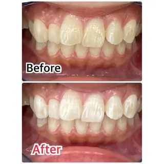 プラチナムビューティー柏所属・【歯科提携】柏ホワイ トニングスタイルのその他イメージ