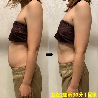 脱毛＆エステサロン【アンリミット】所属・森谷 莉美のエステ・リラクイメージ