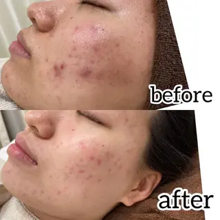 laluna saki...のその他イメージ