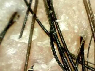 薄毛ケア/痒みケア オガワシンペイのヘアスタイル