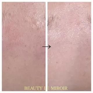 ビューティー ミロワールのエステ・リラクイメージ