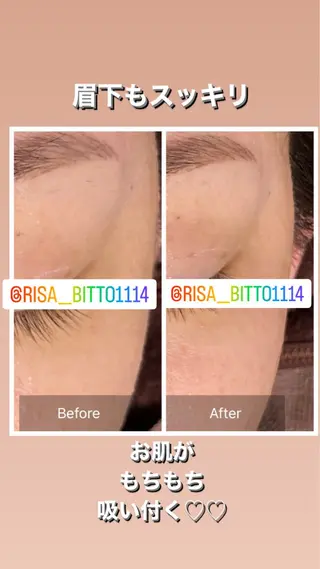 産毛専門店 Bittoのエステ・リラクイメージ