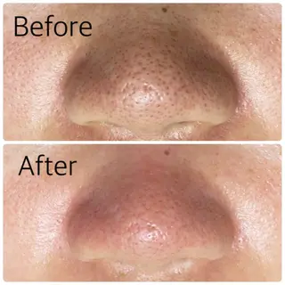 肌質改善 KALANCHOEのエステ・リラクイメージ