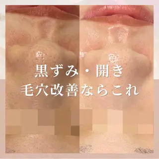 🎀韓国式肌改善🎀 Miku🇰🇷💎のエステ・リラクイメージ