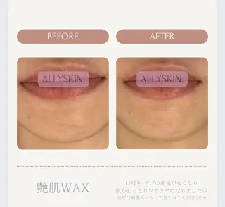 艶肌ワックス ALLY.のエステ・リラクイメージ