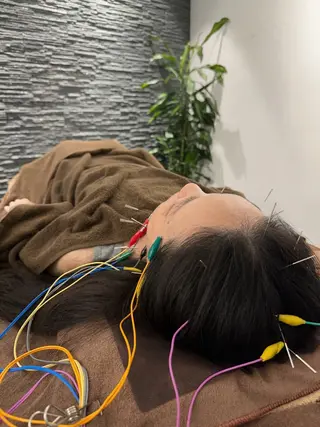 美容鍼灸整体サロンBeauJu所属・小顔矯/美容鍼/鍼灸 BeauJuのその他イメージ