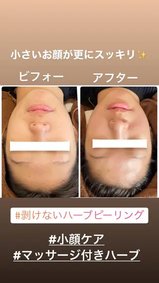 FLEUR大阪・整体 ・ハイフ・痩身・小顔のエステ・リラクイメージ