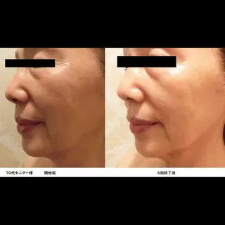 くびれ作り専門サロン こねこのシッポ虎ノ門のエステ・リラクイメージ