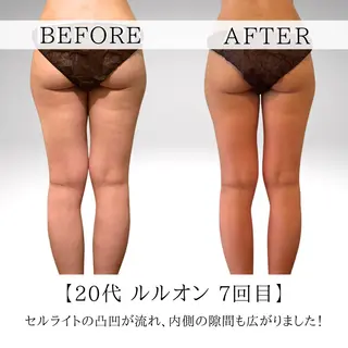 あみ|痩身の最先端 よもぎ蒸しサロン大塚のエステ・リラクイメージ