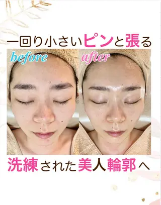 オーダーメイドエステ　ソワンドビジュー所属・美肌×小顔専門/ 亀澤いずみのエステ・リラクイメージ