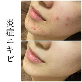 ハーブピーリング専門 BIOEL横浜のエステ・リラクイメージ