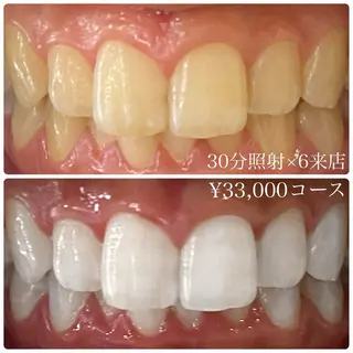 PLATINUM Beauty 横浜店所属・ホワイトニングルーム 横浜店のその他イメージ