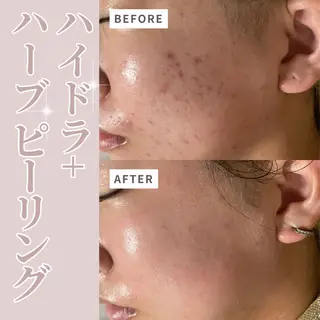 プライベートサロン Belle（ベル）のエステ・リラクイメージ