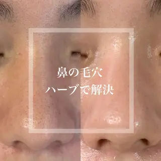 WHITE AQUA 北千住店のエステ・リラクイメージ