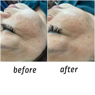 メンズ キッズ Amaryllis 🌹松本のエステ・リラクイメージ