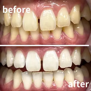 LBSホワイトニング 銀座店💎スタッフ峯のその他イメージ