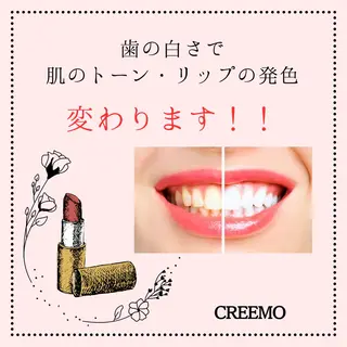 歯のホワイトニング HARU南浦和のその他イメージ