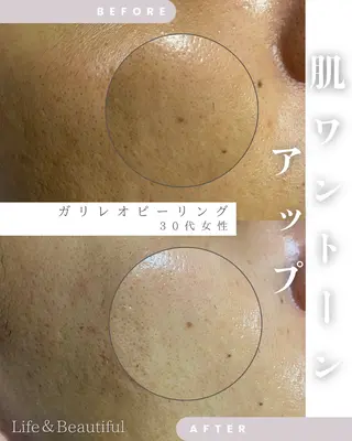 Life＆ Beautifulのエステ・リラクイメージ