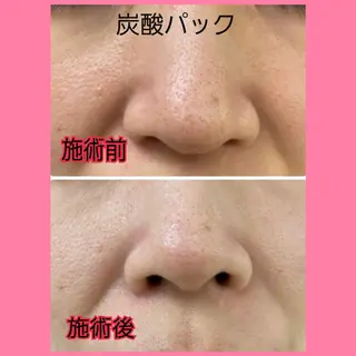 肌ケア＆毛穴洗浄 Cheriのエステ・リラクイメージ