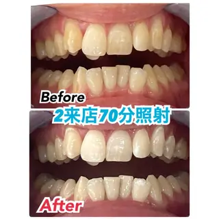 メンズ キッズ ネイル マツエク・マツパ アイブロウ プラチナムビューティー柏所属・【歯科提携】柏ホワイ トニングスタイルのその他イメージ