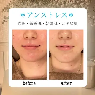 🦋美肌サロン. maho🦋のエステ・リラクイメージ