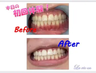 セルフホワイトニングサロン　ラヴィアン所属・ホワイトニングサロン La vie enのその他イメージ