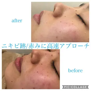 ショート カラー パーマ ヘアアレンジ キッズ ネイル マツエク・マツパ Ensor Clair所属・EnsorClair 代表 野口真央のエステ・リラクイメージ