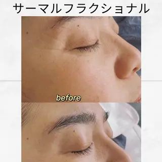 西区九条エステ MITUREIサロンのエステ・リラクイメージ