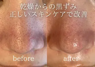 Peerless所属・菅原 智香のエステ・リラクイメージ