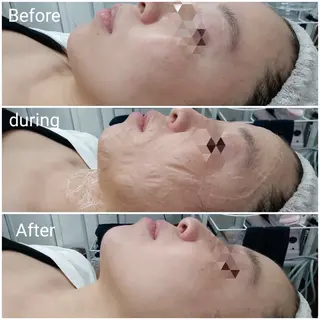 肌質改善Beauty salon Renのエステ・リラクイメージ