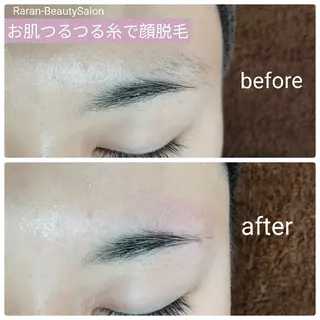 若返り 美肌   エステサロンららんのエステ・リラクイメージ