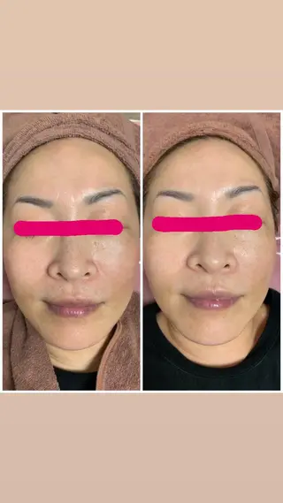 透明感の肌Lino malieのエステ・リラクイメージ