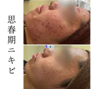 ハーブピーリング専門 BIOPLUS＋川崎のエステ・リラクイメージ