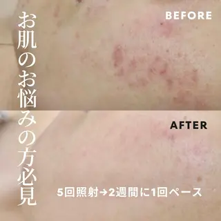 メンズ 脱毛しま専科 宗右衛門町店のエステ・リラクイメージ